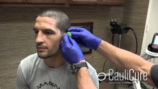 How to cure cauliflower ears for good